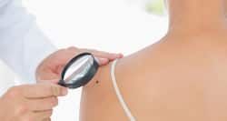 Compare your symptoms to these 10 common skin conditions