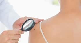 Compare your symptoms to these 10 common skin conditions