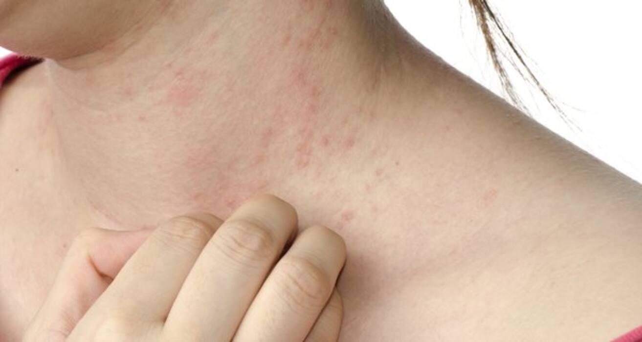 Compare your symptoms to these 10 common skin conditions