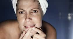 Beware! These 6 foods are silently worsening your skin condition