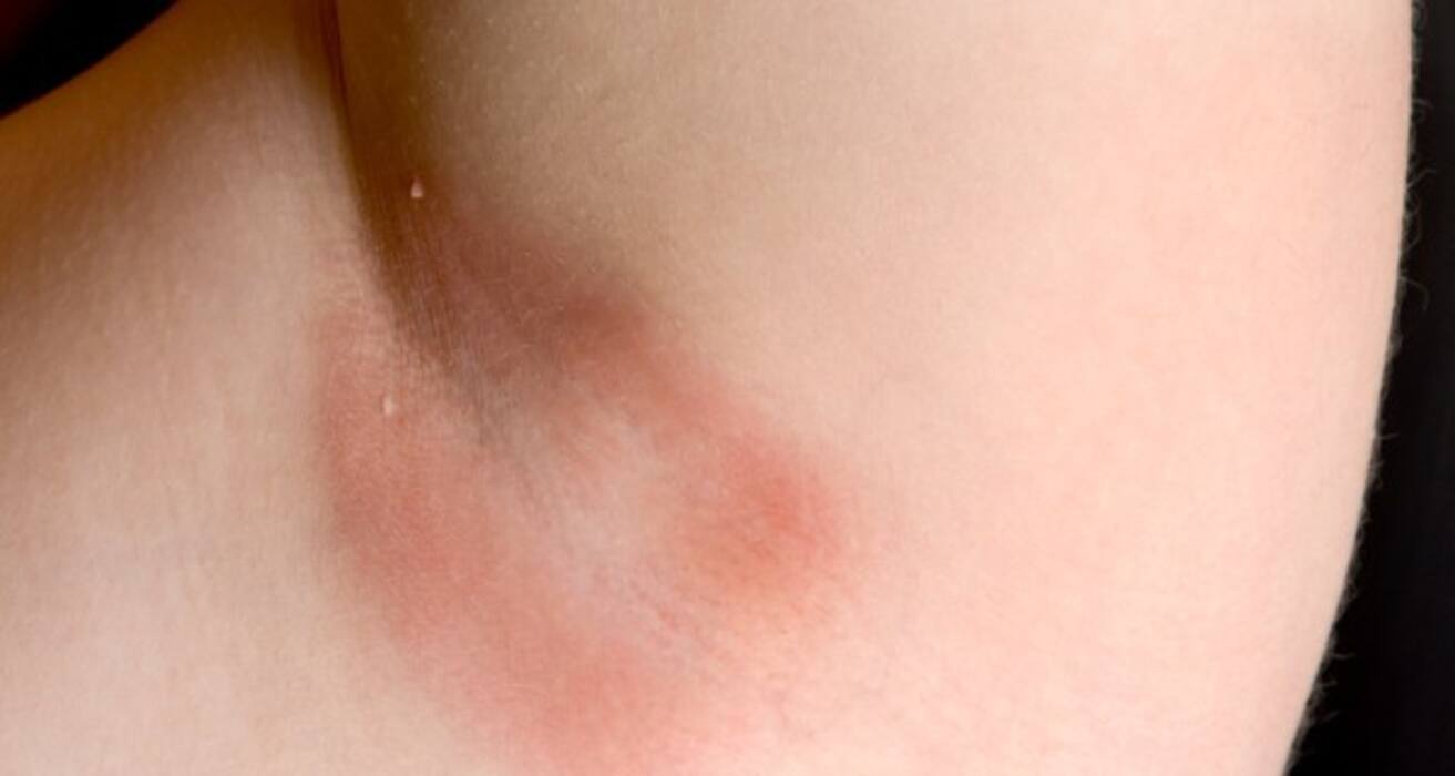Compare your symptoms to these 10 common skin conditions