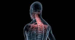 Frequent back aches and joint pain could mean osteoporosis
