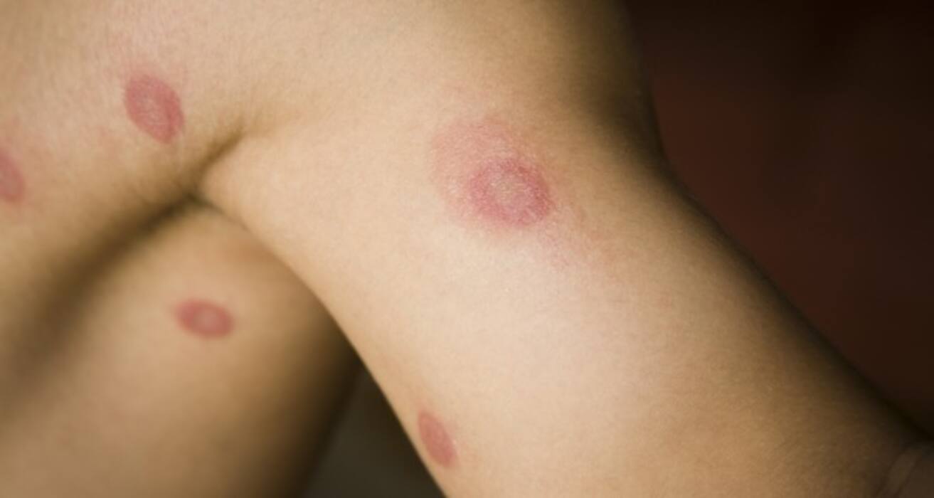 Compare your symptoms to these 10 common skin conditions