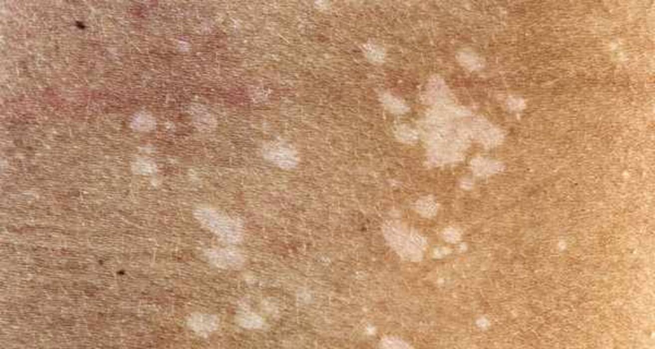 Compare your symptoms to these 10 common skin conditions