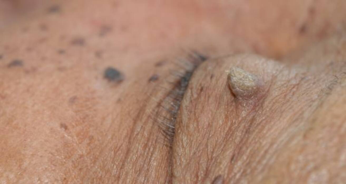 Compare your symptoms to these 10 common skin conditions