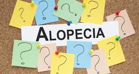 Homeopathy for alopecia and hairloss -- Everything you need to know