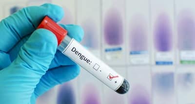 Dengue can damage your brain! Experts talk about symptoms to watch out for