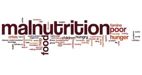 'Malnutrition, anaemia pose huge health challenge to India'- Global Nutrition Report 2017