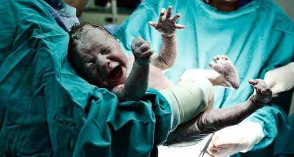 premature baby