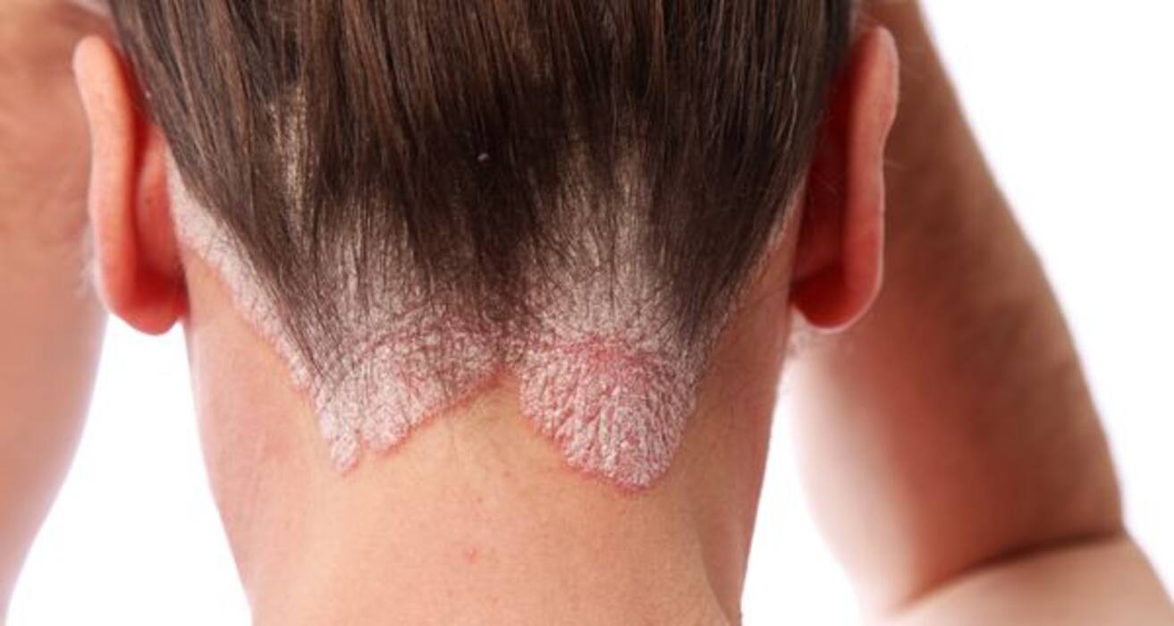 Compare your symptoms to these 10 common skin conditions