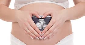 Should you worry if your sonography shows ‘cord around the baby's neck'?