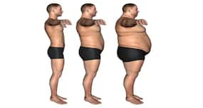 16 reasons obesity is UGLY (and we are not talking about the way you look)