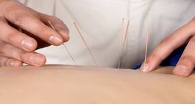 Here's what to expect when going for an acupuncture treatment
