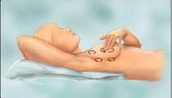 Breast size dissatisfaction affects self-examination