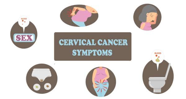 Of cancer signs 10 cervical 10 Warning