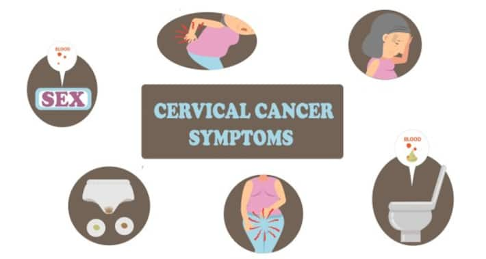 Identifying these 10 symptoms of cervical cancer on time can save your