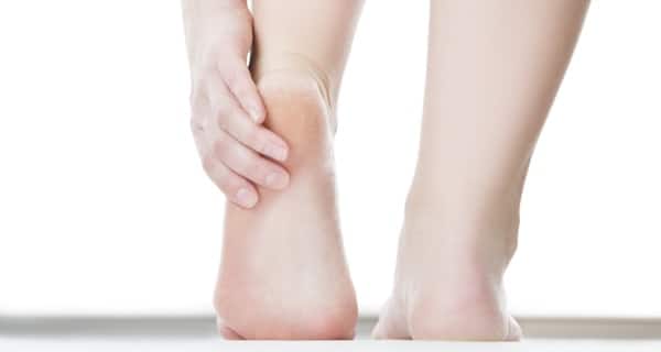What Causes Cracked Heels? | Beauty and Style