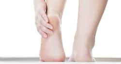 5 dermatologist recommended creams for cracked heels