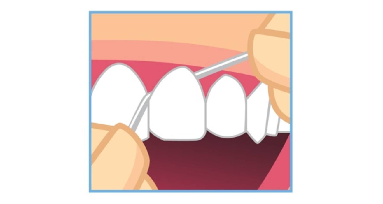 Are you brushing and flossing correctly?