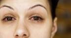 One natural remedy for conjunctivitis that WORKS!