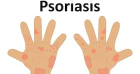World Psoriasis Day -- 8 tips to manage psoriasis during winter