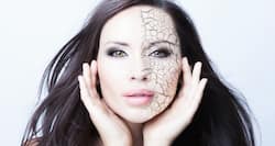 7 ways to avoid dry skin this winter (besides moisturising)