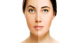 Skin lightening creams or natural remedies -- how to get rid of a sun tan?