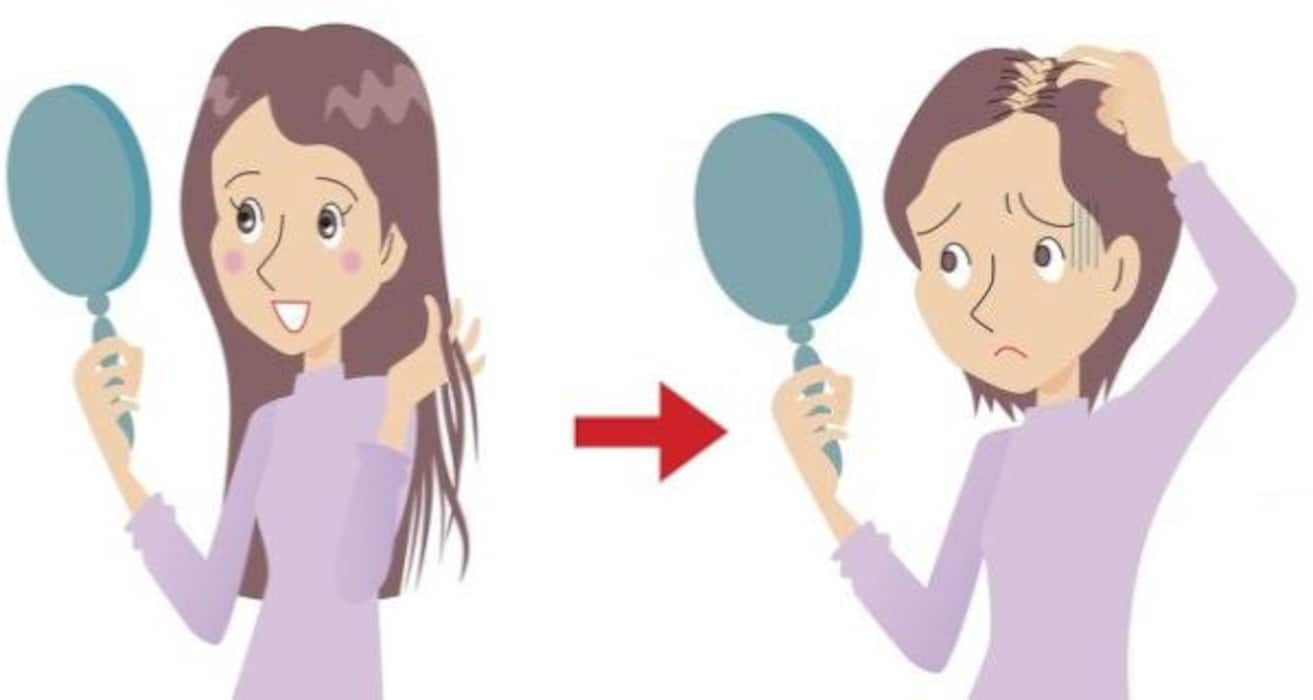 7 symptoms of PCOS every woman should be aware of!