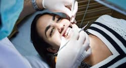 Bioactive glass to reduce decay in tooth cavity fillings