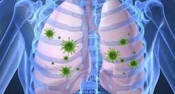 Good bacteria might inhibit the growth of pneumonia causing bacteria, says study