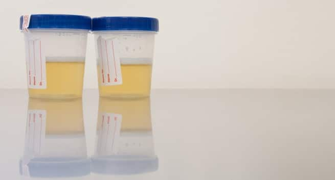 10 things your pee tells about your health | TheHealthSite.com