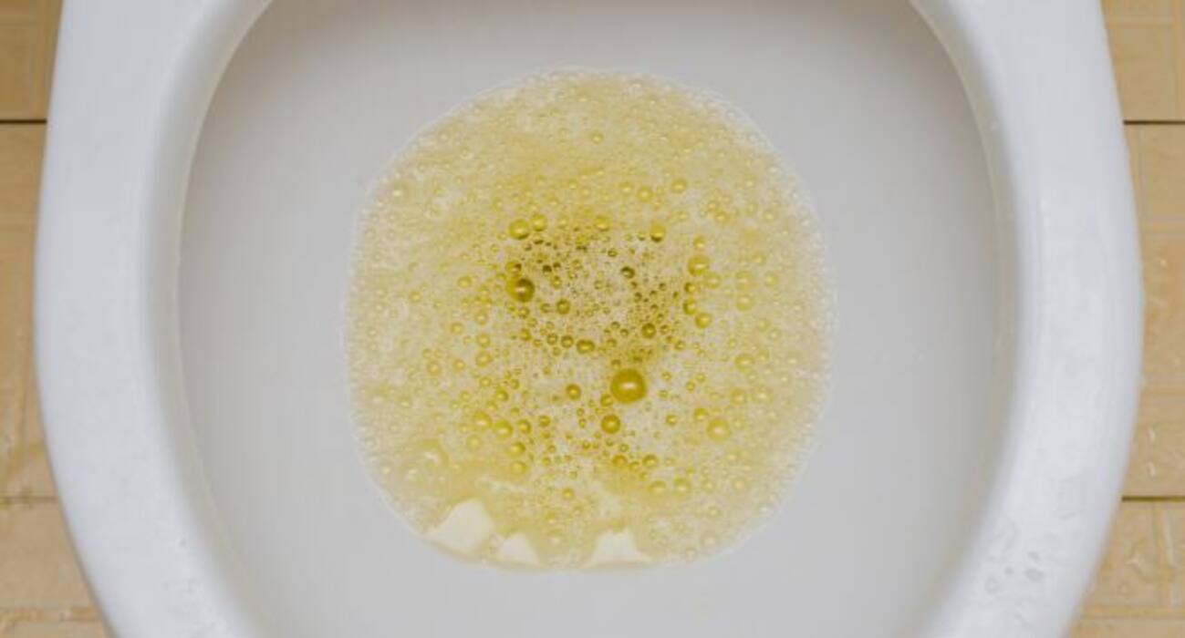 10 things your pee tells about your health