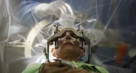 Is hypnosis a new alternative for 'awake brain surgery'?