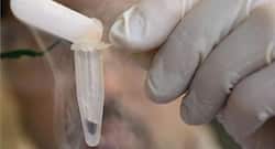 Kochi surgeons successfully carry out Asia's first trachea transplant