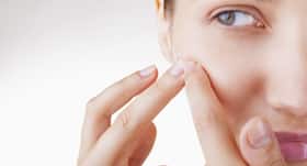 Here's why it can be dangerous to pop a whitehead