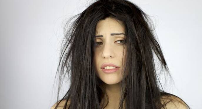 How Long Does Seasonal Hair Loss Last?