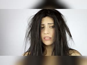 How Long Does Seasonal Hair Loss Last?