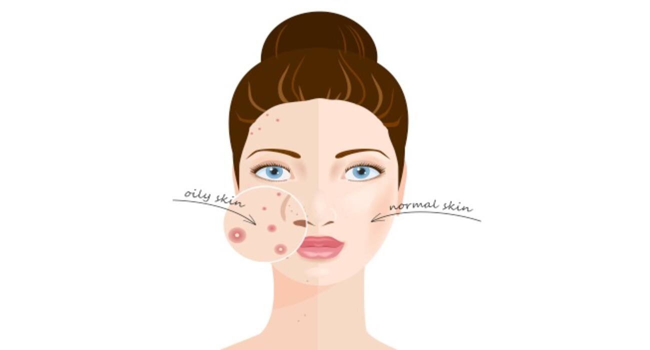 11 expert-reccomended ways to prevent a stye or eye pimple