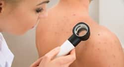 8 ways to prevent folliculitis from recurring