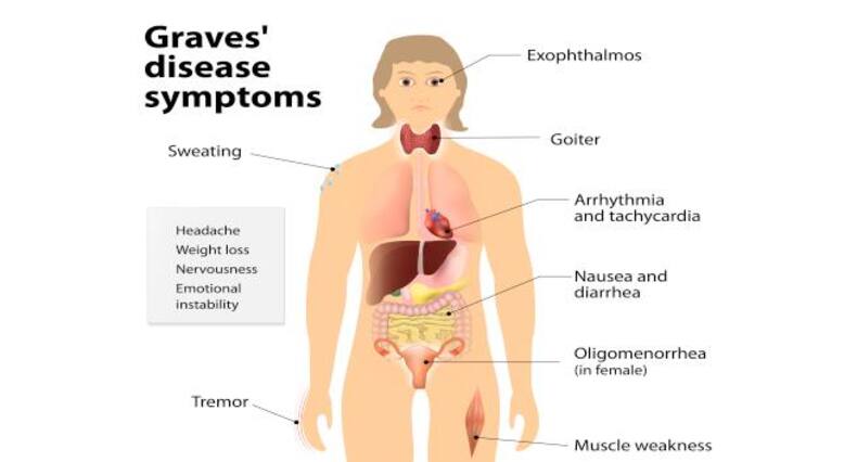 graves-disease