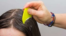 5 tips to to protect your kids from head lice