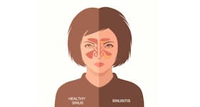 Suffering from sinusitis? Pineapple can help!