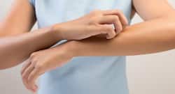 Want to treat bumps on the skin? Try these 3 home remedies