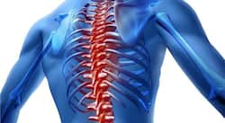 Hormone therapy can reduce age-related curvature of spine in women