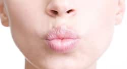 6 foods to prevent and heal dry, chapped lips