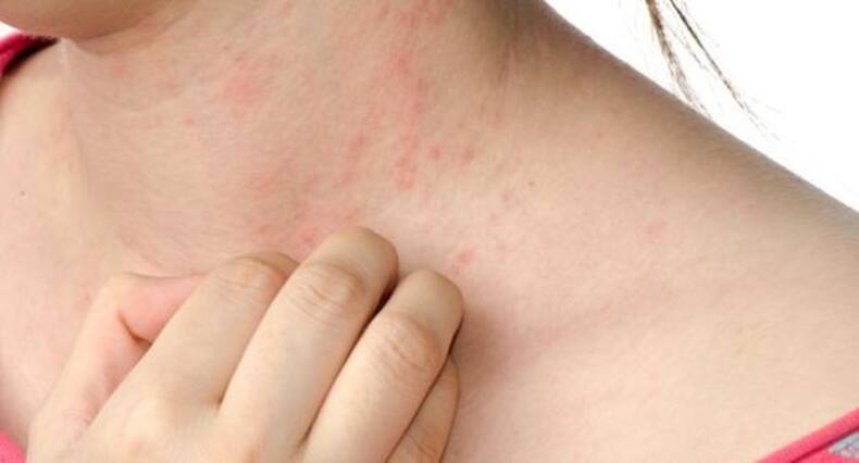 7 signs of candida (yeast) infection you should NEVER ignore