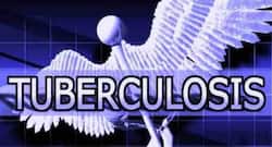 Khatri test -- a simple blood test to detect people suffering from active tuberculosis (TB)