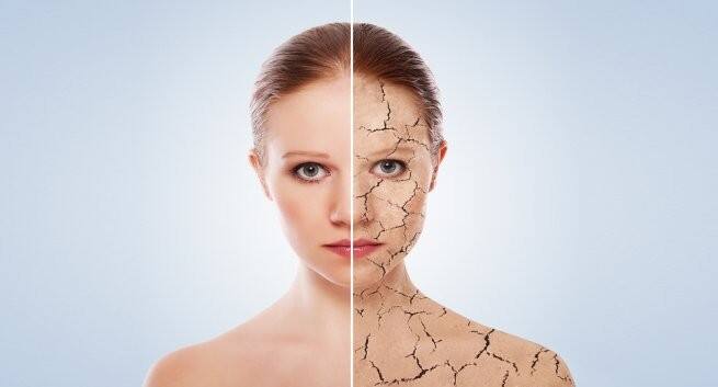 Beauty Tip 5 Products To Avoid If You Have Dry Skin