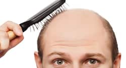 Laser comb: Does it really stimulate hair growth and stop hair loss?