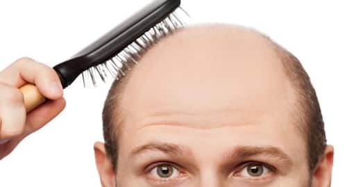 Laser comb: Does it really stimulate hair growth and stop hair loss? |  